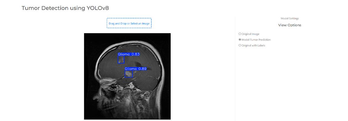 Students Francisco Ribeiro Mansilha and Lea Banovac use AI to detect brain tumors