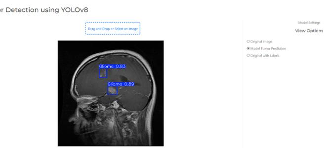 Students Francisco Ribeiro Mansilha and Lea Banovac use AI to detect brain tumors 